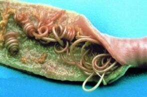 Στρογγυλά σκουλήκια