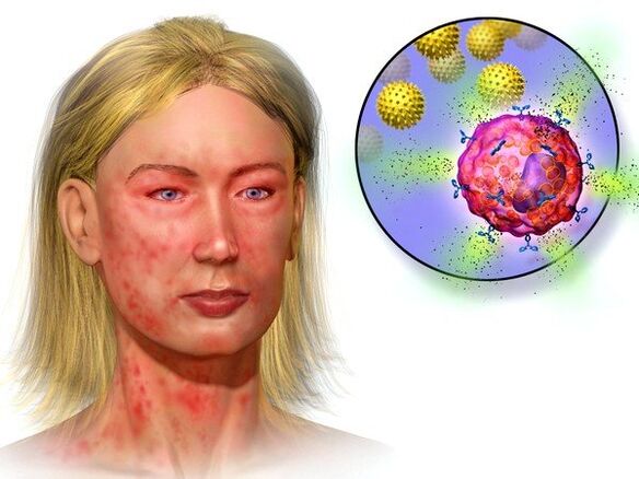 Εχινόκοκκοι και συμπτώματα της παρουσίας τους στο σώμα